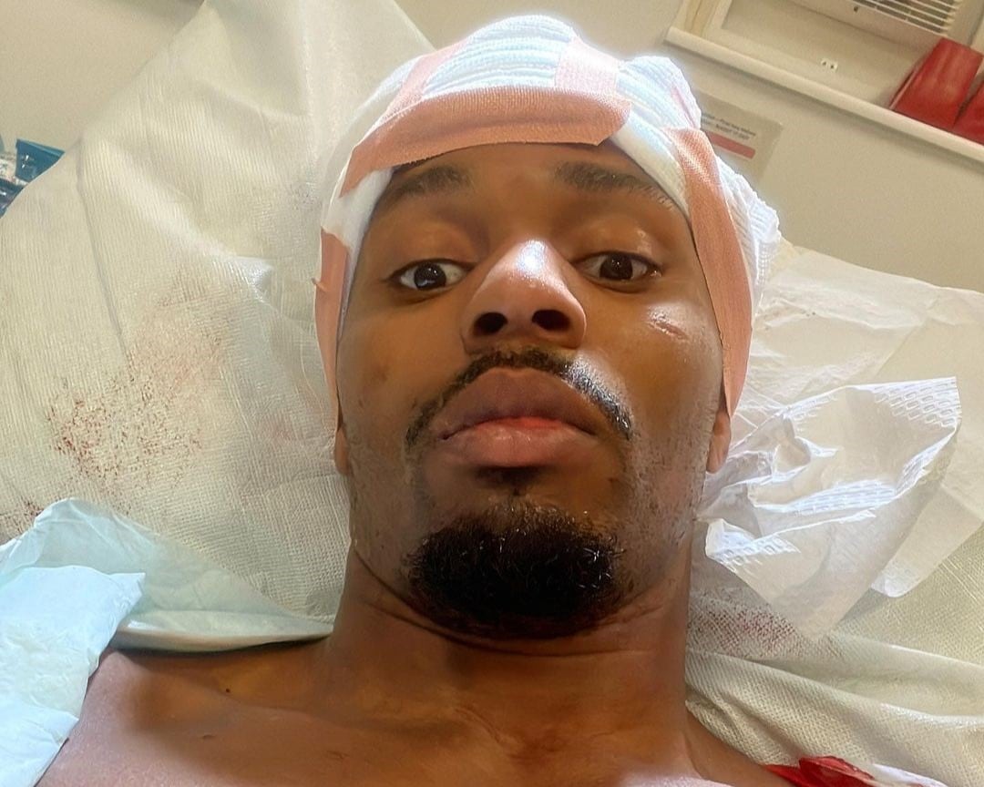 Lutador do UFC, Lerone Murphy internado no hospital após acidente de trânsito. Foto: Reprodução/Instagram @lerone145